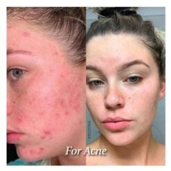 Huile Visage Glory Oil - 30ml -RMS Beauty Boutique huile visage bio miraculeuse eco by sonya 4